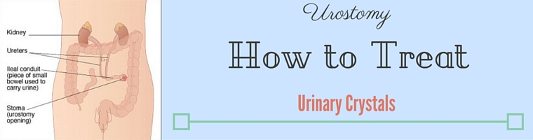 How to Treat Urinary Crystal Build Up in Urostomy