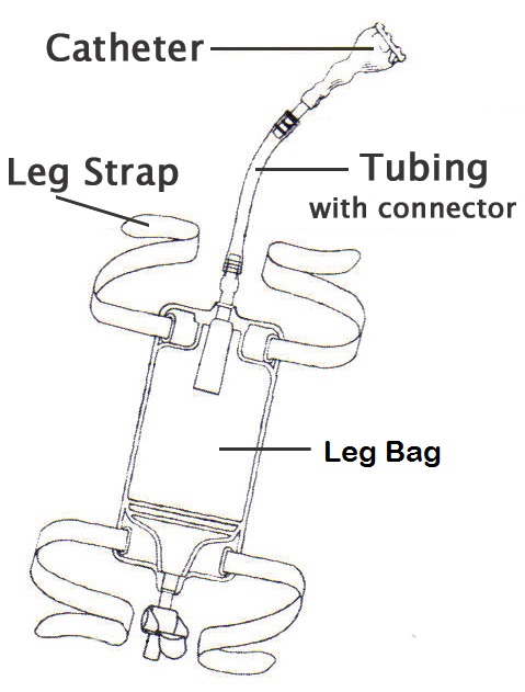 External Catheter Connected to Urinary Leg Bag Diagram