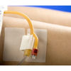 Picture of Cath Secure - Multi-Purpose Medical Tube Holder