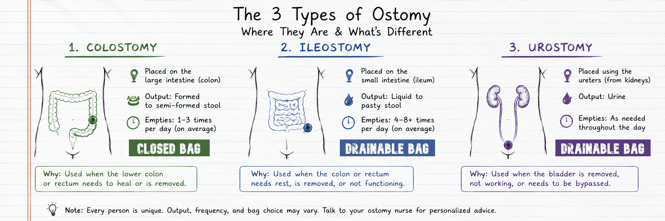 TypesOfOstomies