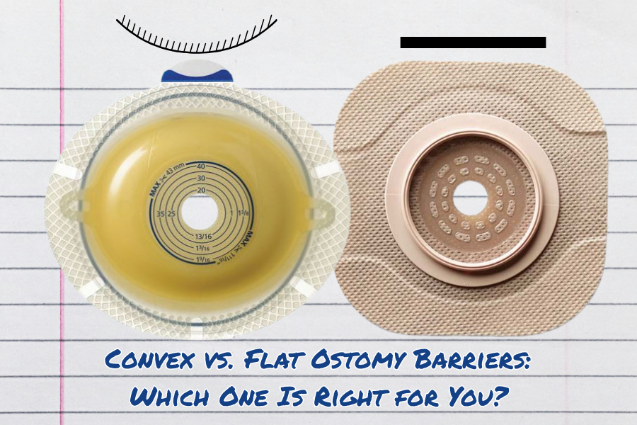 ConvexVsFlatBarrierForResourceCenter