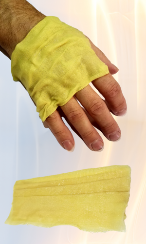 Hand with Xeroform dressing, dressing opened